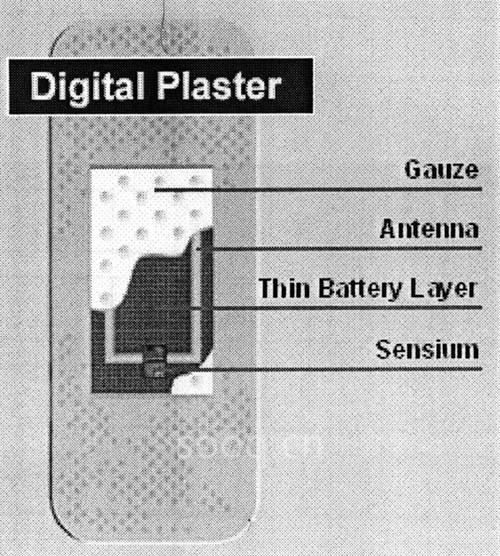 数字电子诊疗贴